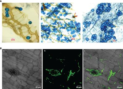 Root colonization by the endophytic fungus Piriformospora indica shortens the juvenile phase of Piper nigrum L. by fine tuning the floral promotion pathways
